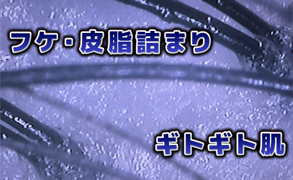 「もう歳だから」とあきらめていませんか？