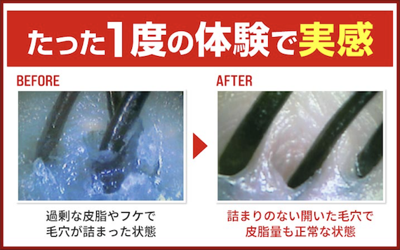 「もう歳だから」とあきらめていませんか？